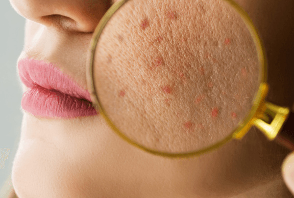 Visita dermatologica